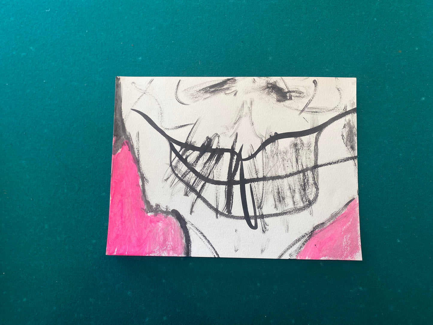 Cracked Lips